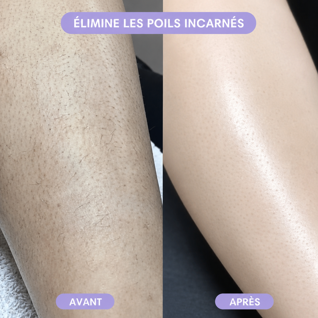 Pierre dépilatoire nouvelle génération