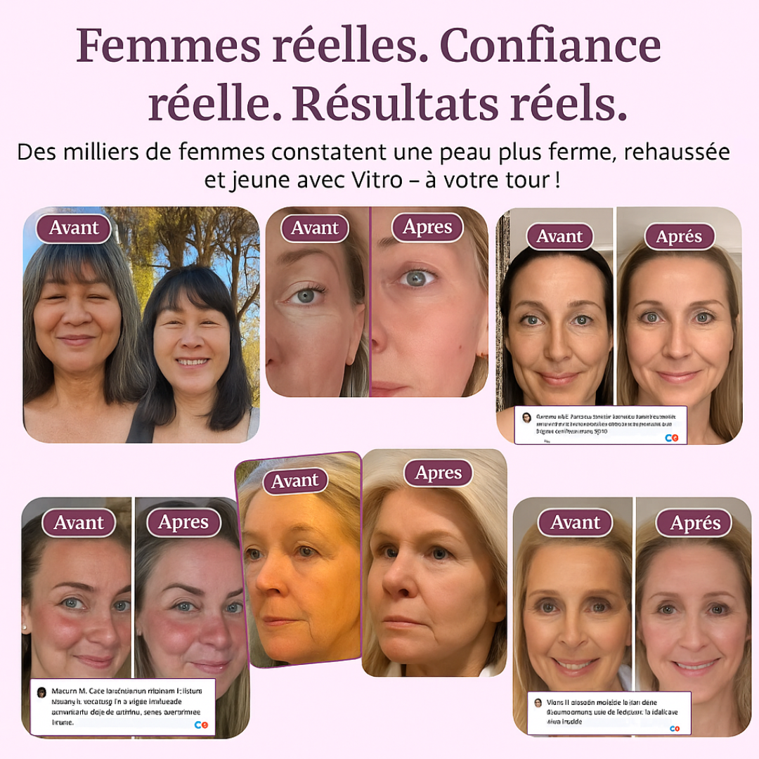 Baume anti-cerne