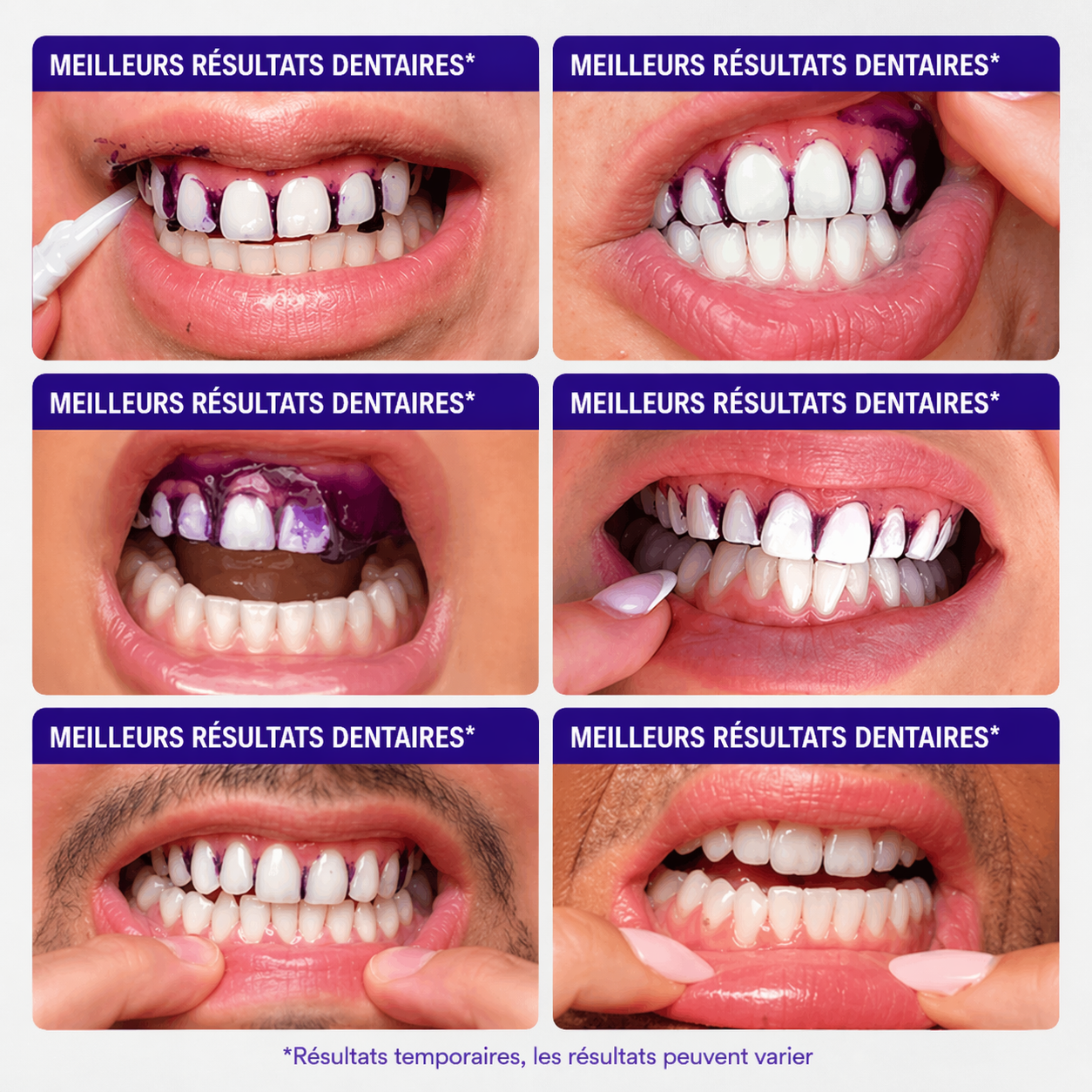 28 Bandes blanchissantes pour les dents