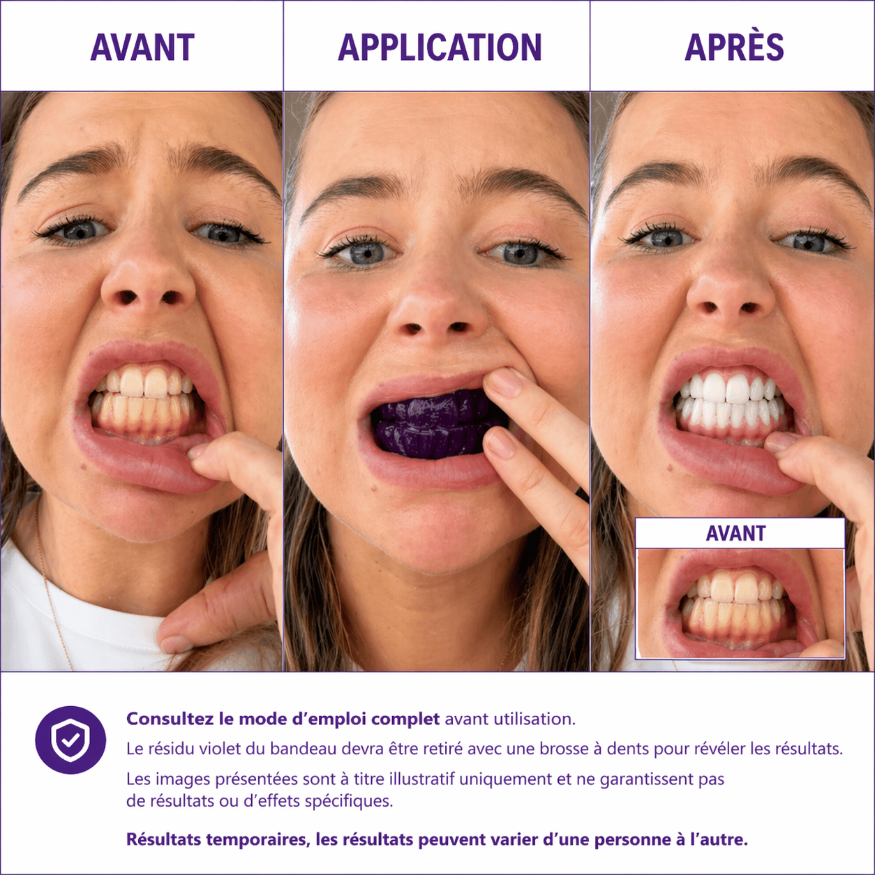 28 Bandes blanchissantes pour les dents
