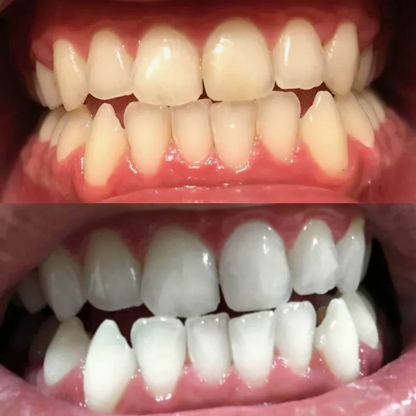 28 Bandes blanchissantes pour les dents